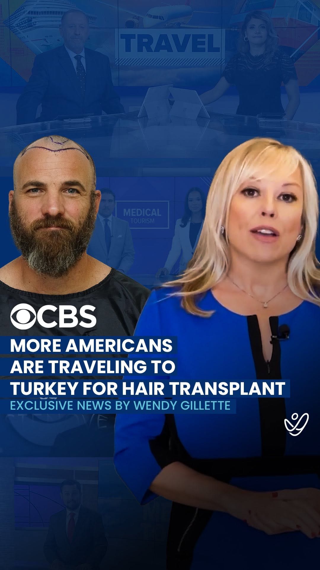 Post 8 by Estenove Hair Transplant Turkey on Instagram (video)
