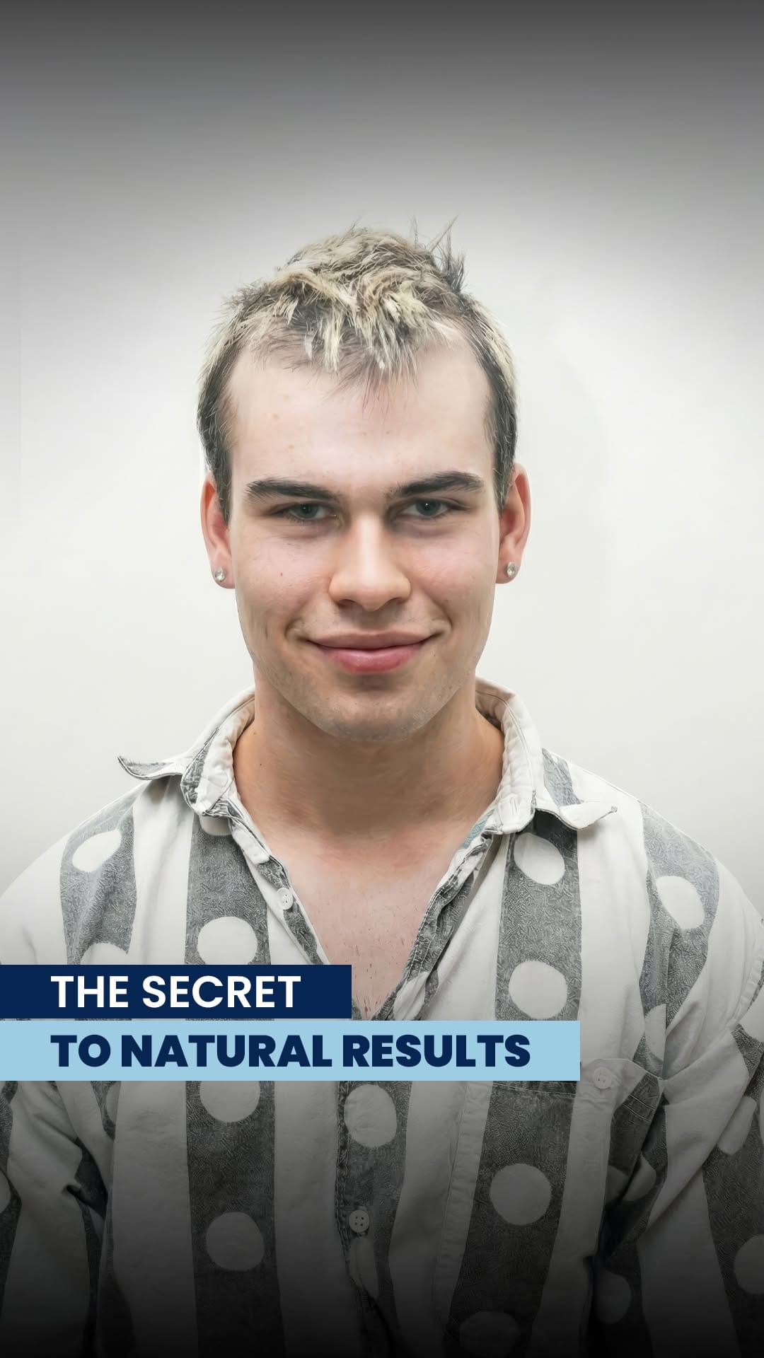 Post 7 by Estenove Hair Transplant Turkey on Instagram (video)