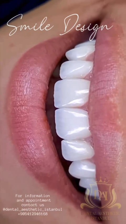 Post 8 by Diş Kliniği on Instagram (video)