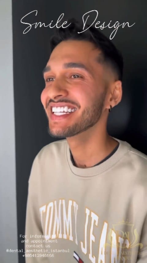 Post 3 by Diş Kliniği on Instagram (video)