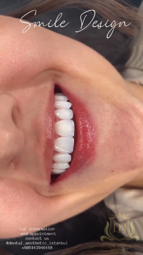 Post 1 by Diş Kliniği on Instagram (video)