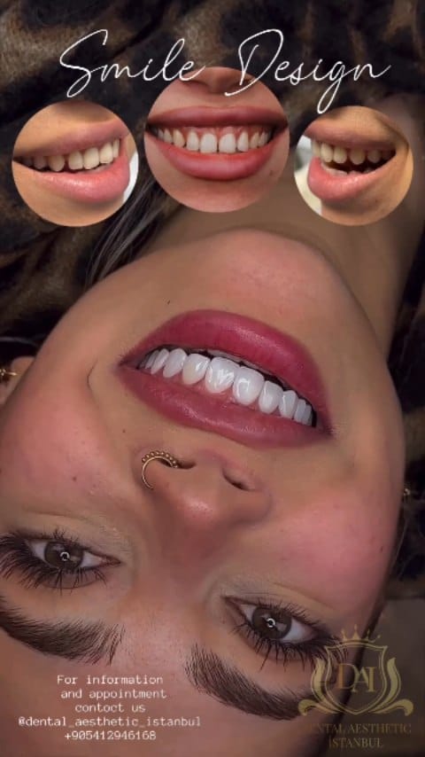 Post 4 by Diş Kliniği on Instagram (video)
