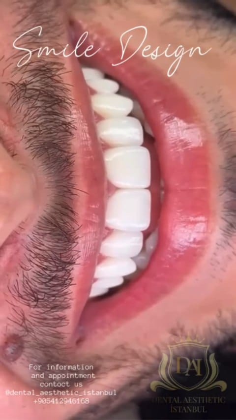 Post 7 by Diş Kliniği on Instagram (video)