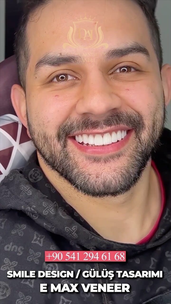 Post 9 by Diş Kliniği on Instagram (video)