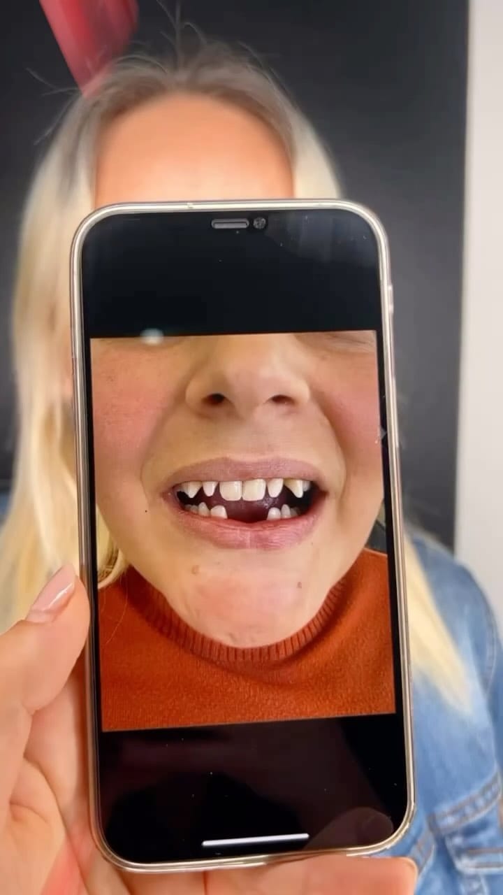 Post 6 by Diş Kliniği on Instagram (video)