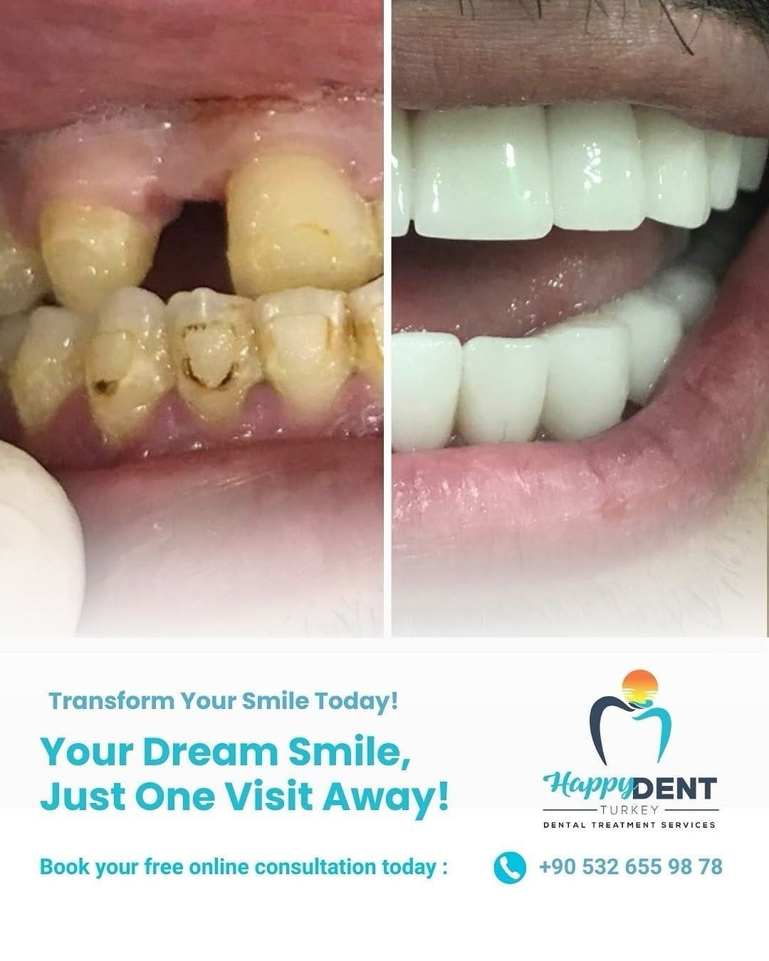Post 9 by Happy Dent Turkey on Instagram (image)