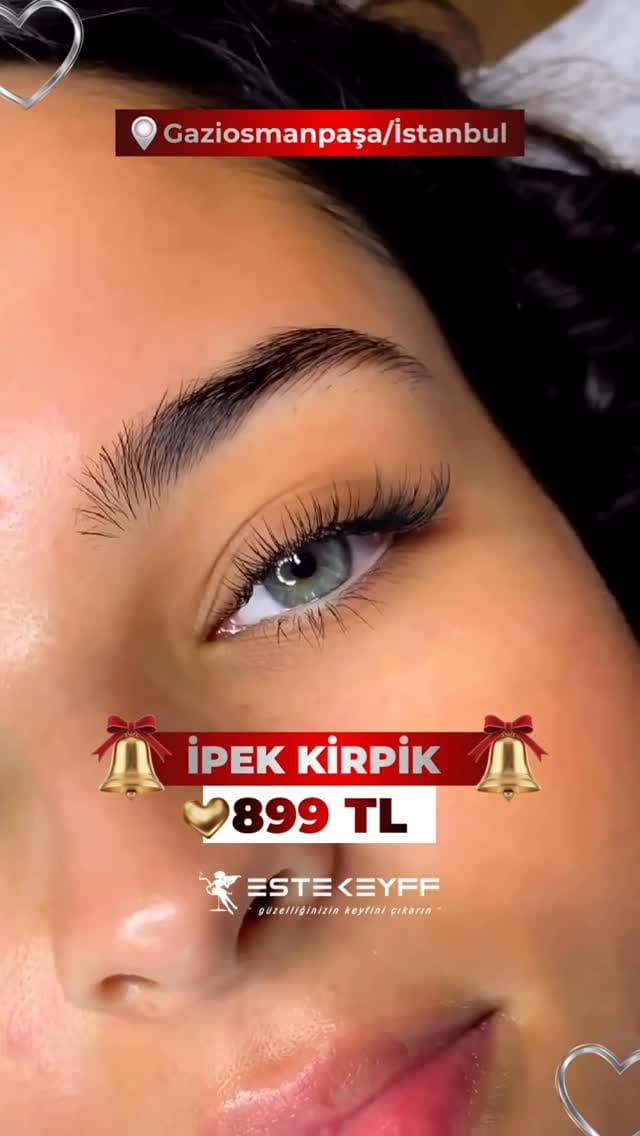Post 2 by EsteKeyff Lazer Epilasyon Cilt Bakımı Zayıflama Tırnak Studio on Instagram (video)