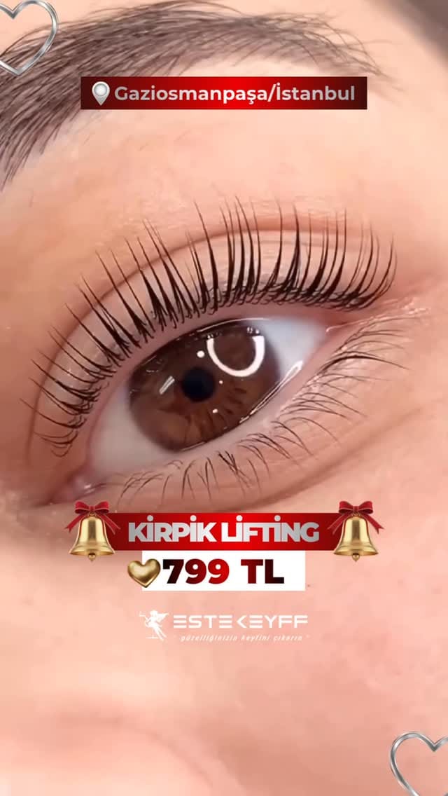 Post 1 by EsteKeyff Lazer Epilasyon Cilt Bakımı Zayıflama Tırnak Studio on Instagram (video)