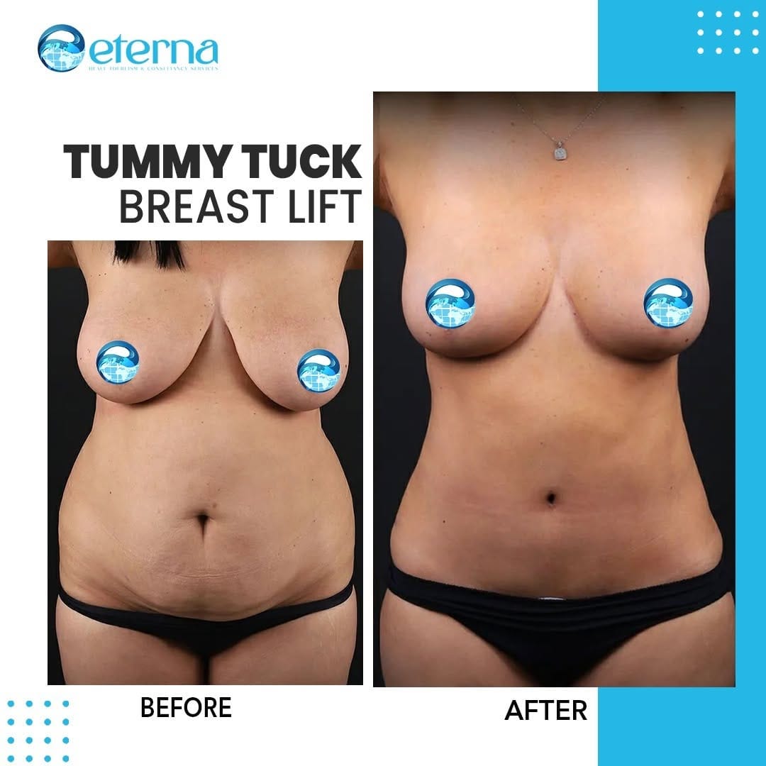 Post 10 by Eterna Health Group International on Instagram (carousel)