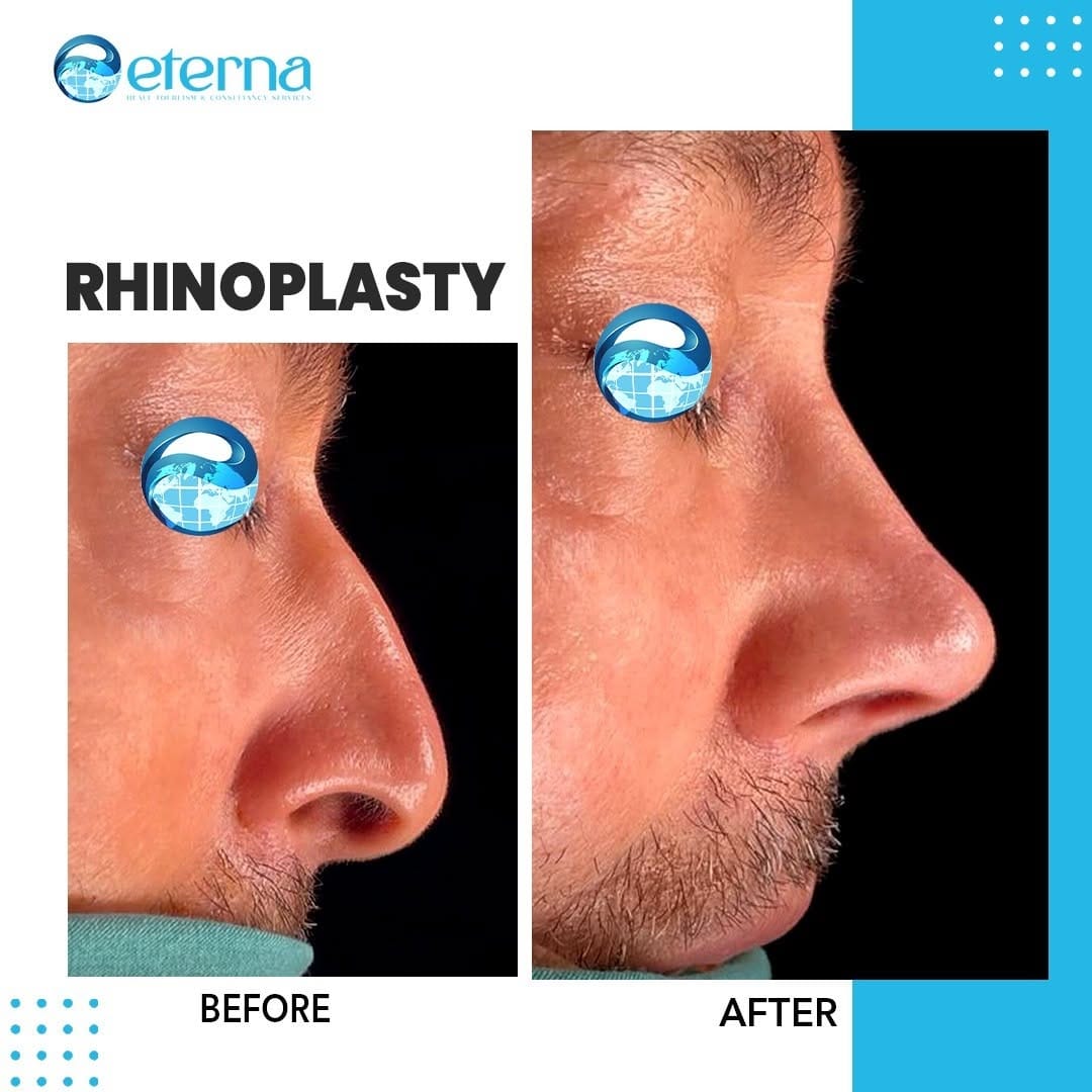 Post 4 by Eterna Health Group International on Instagram (carousel)