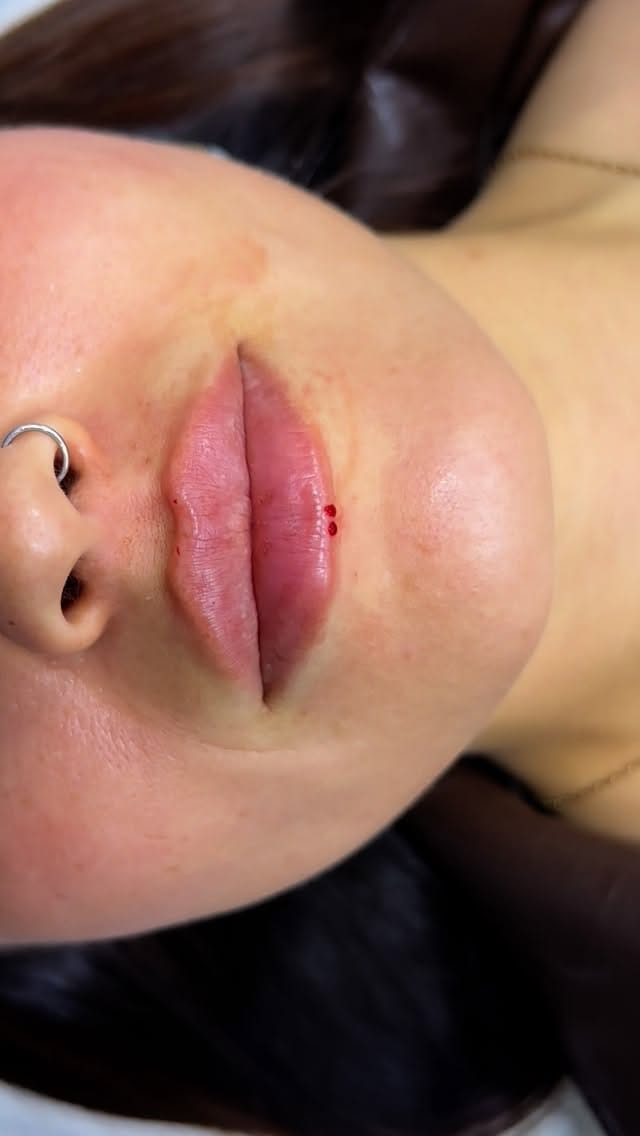 Post 2 by Durra Clinic on Instagram (video)