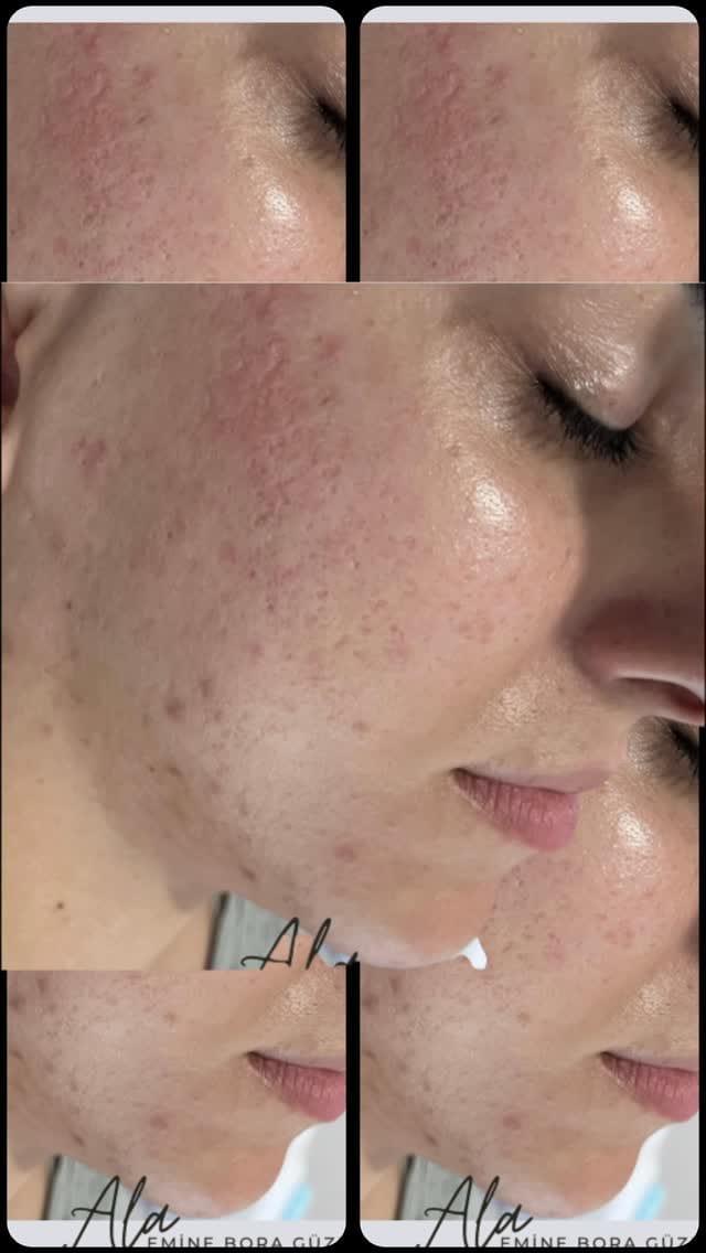 Post 6 by Güzellik uzmanı usta öğretici emine bora on Instagram (video)