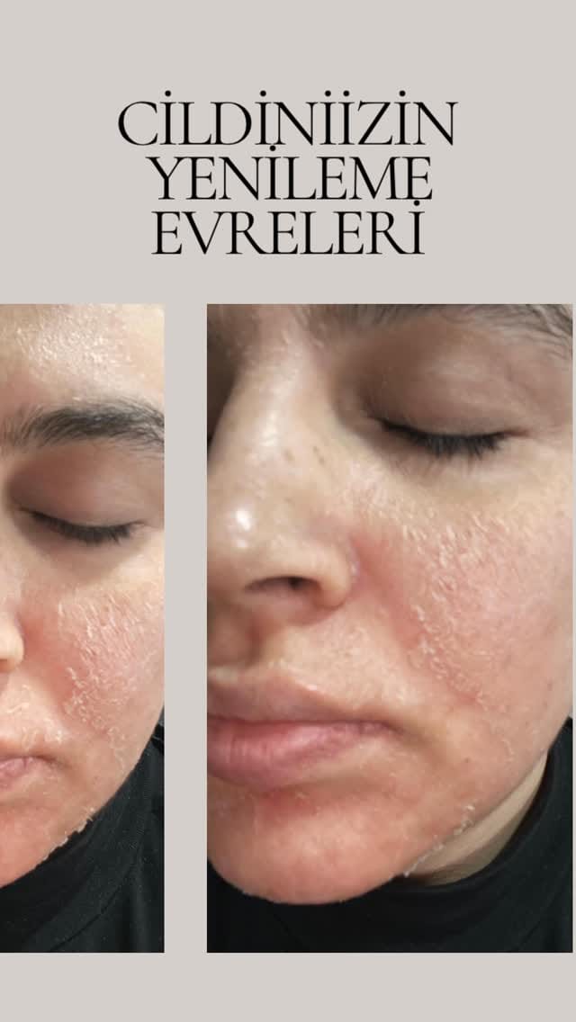 Post 4 by Güzellik uzmanı usta öğretici emine bora on Instagram (video)