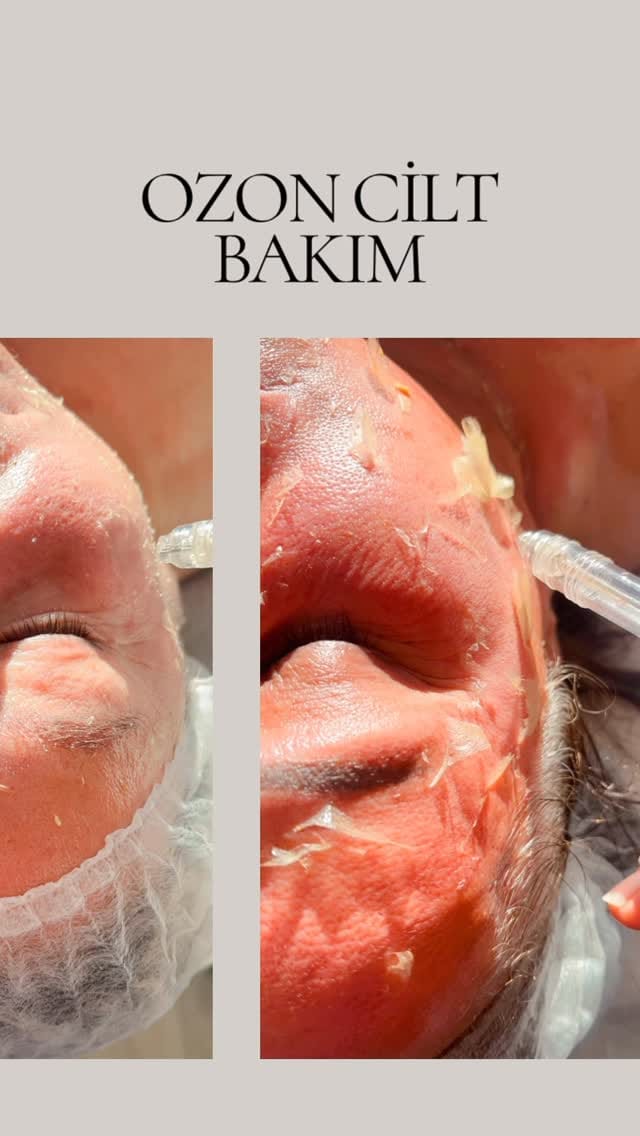 Post 2 by Güzellik uzmanı usta öğretici emine bora on Instagram (video)