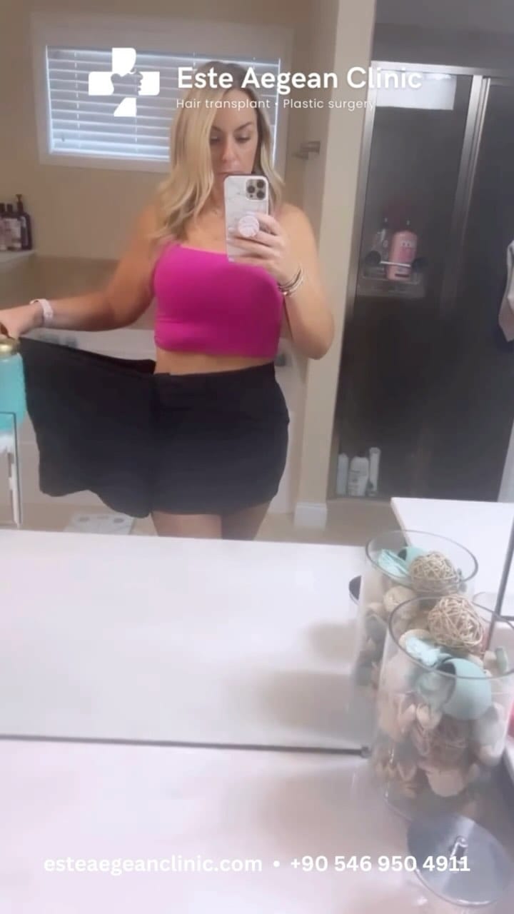 Post 2 by Este Aegean Clinic - Gastric Sleeve on Instagram (video)