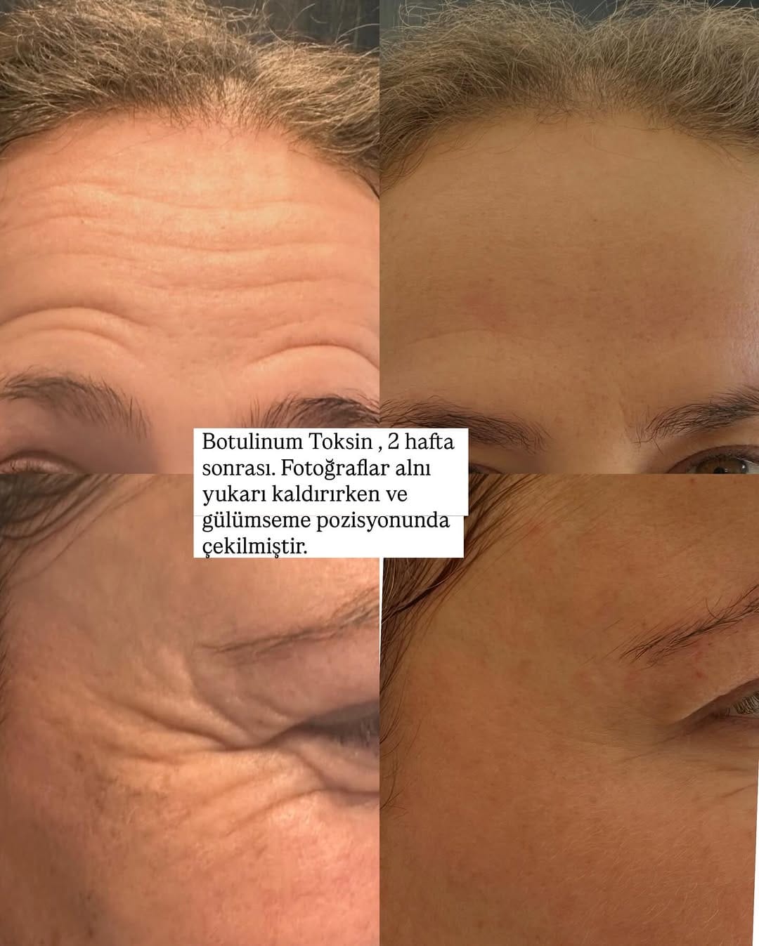 Post 1 by Dermatolog Dr. Ayşe Naren on Instagram (image)