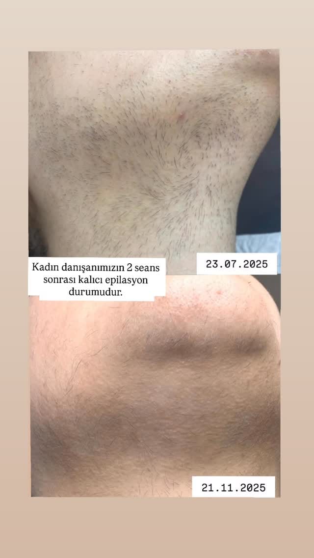 Post 8 by Dermatolog Dr. Ayşe Naren on Instagram (video)