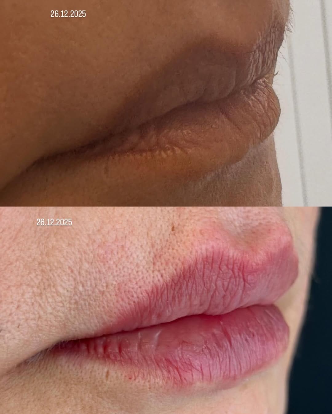 Post 7 by Dermatolog Dr. Ayşe Naren on Instagram (image)