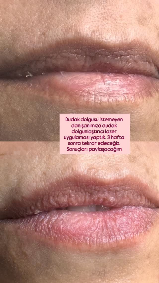 Post 2 by Dermatolog Dr. Ayşe Naren on Instagram (video)