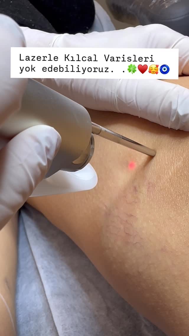 Post 10 by Dermatolog Dr. Ayşe Naren on Instagram (video)