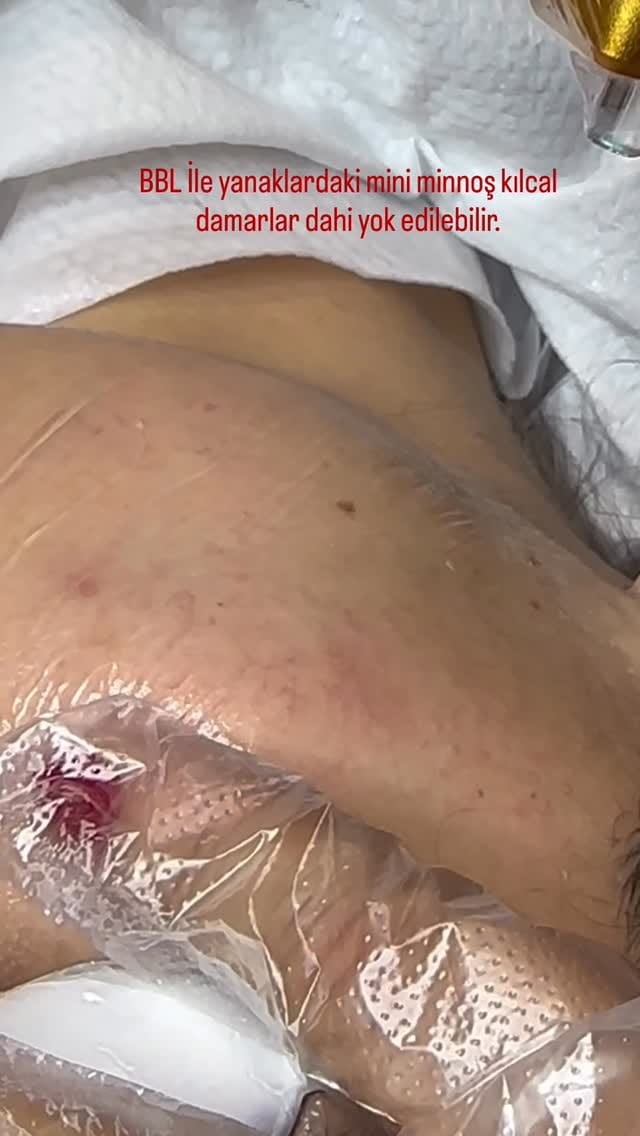Post 5 by Dermatolog Dr. Ayşe Naren on Instagram (video)