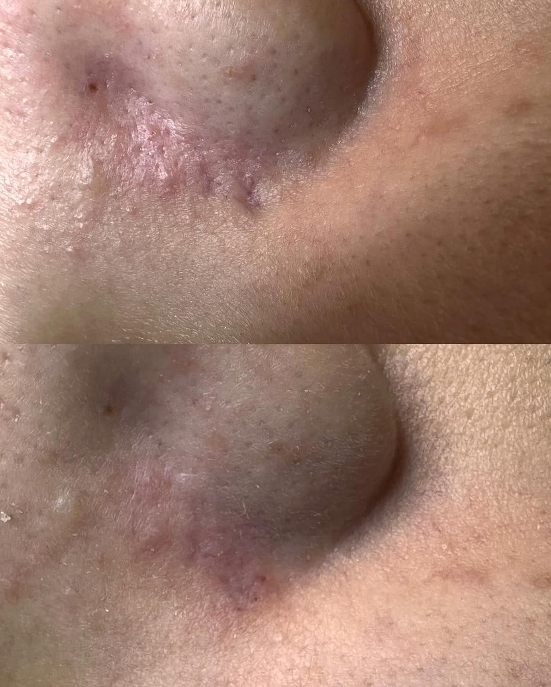 Post 6 by Dermatolog Dr. Ayşe Naren on Instagram (image)