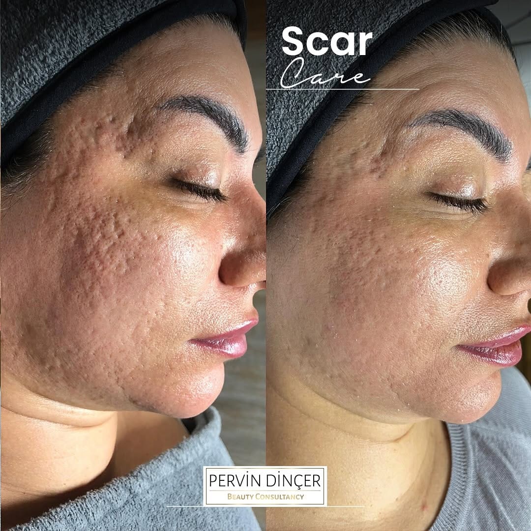 Post 9 by Pervin Dinçer Güzellik Salonu on Instagram (image)