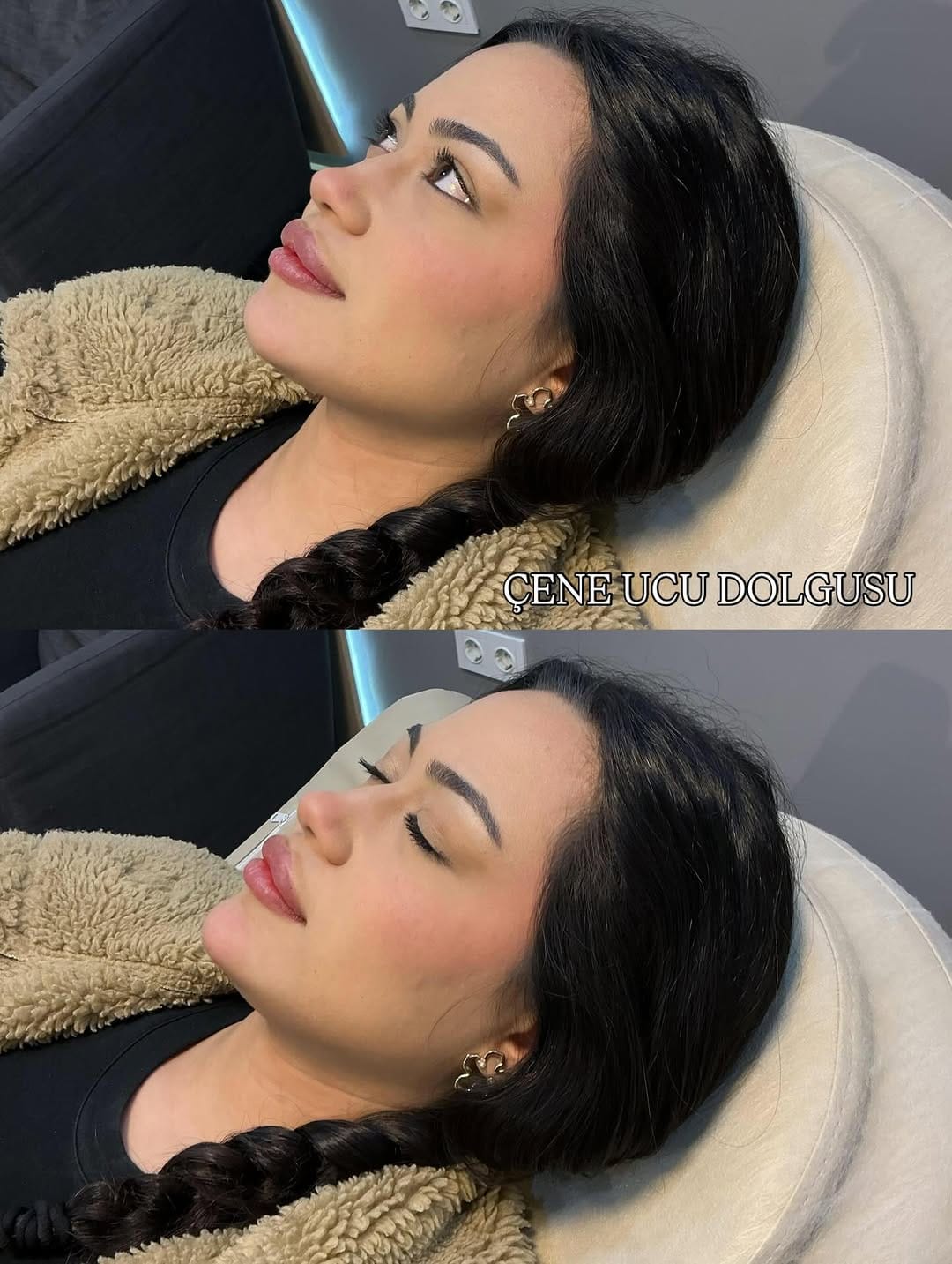 Post 2 by Derma Skins on Instagram (image)