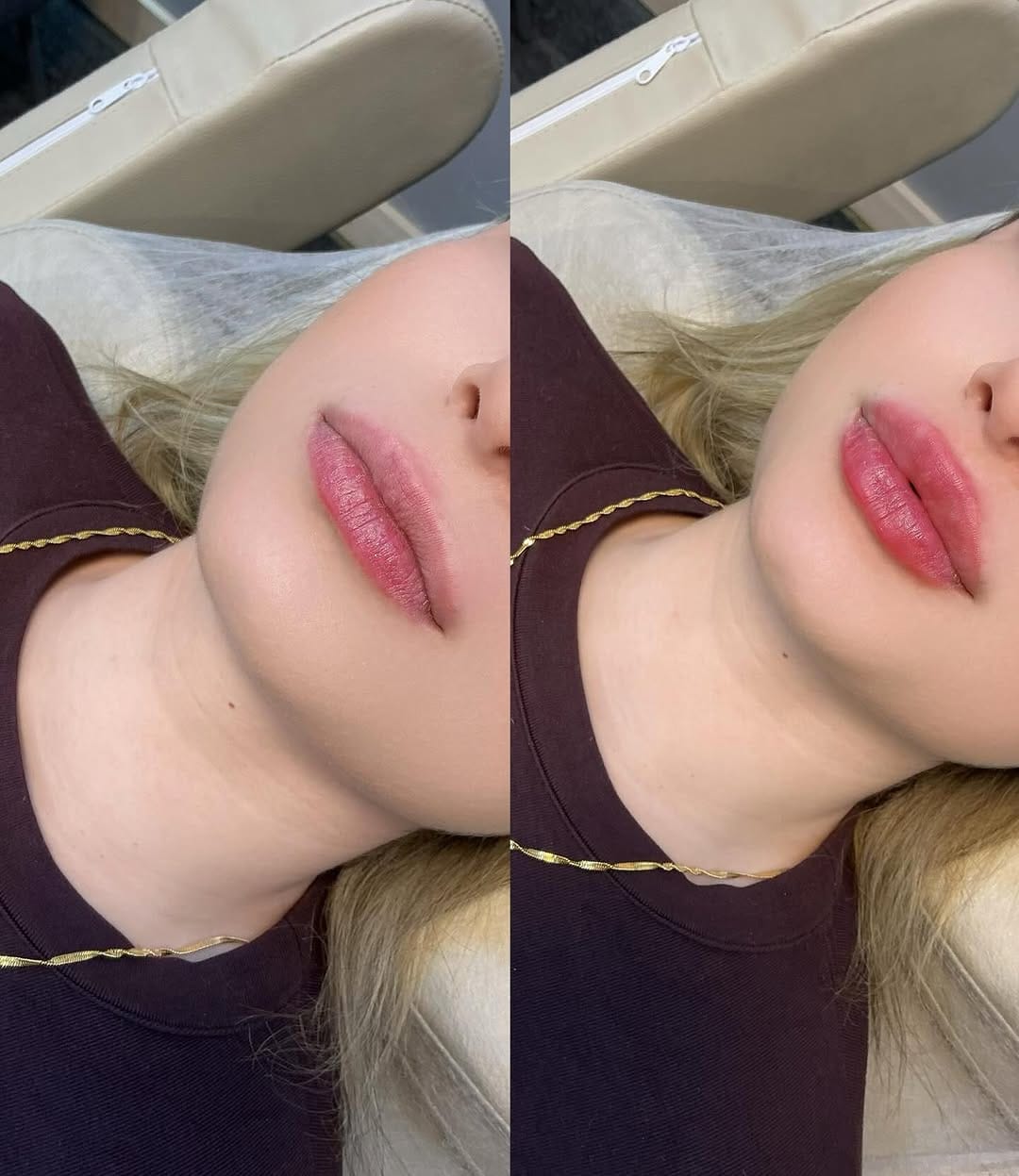 Post 5 by Derma Skins on Instagram (image)