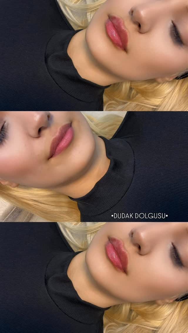 Post 4 by Derma Skins on Instagram (video)