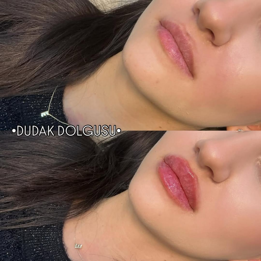 Post 7 by Derma Skins on Instagram (image)
