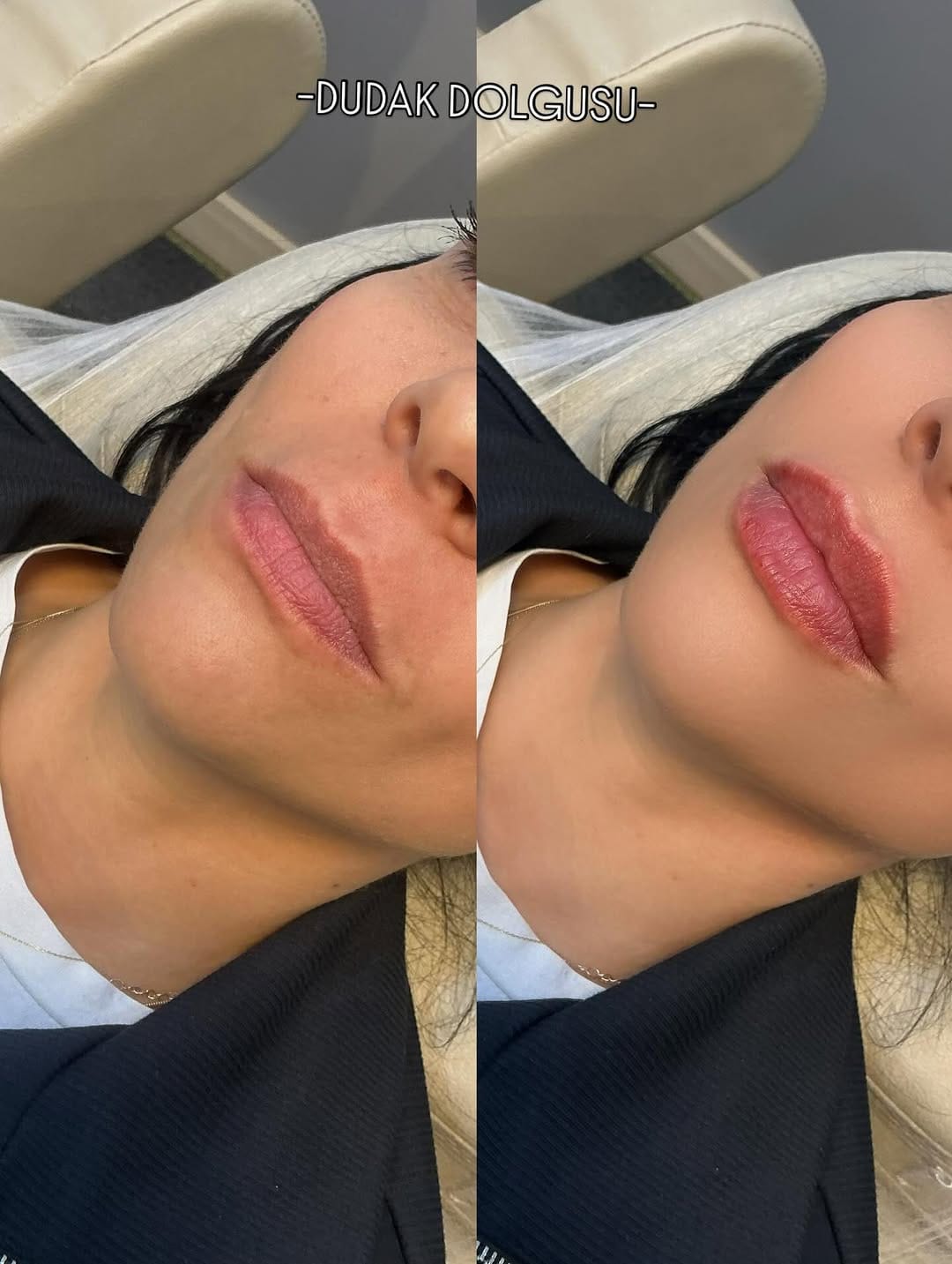 Post 3 by Derma Skins on Instagram (image)