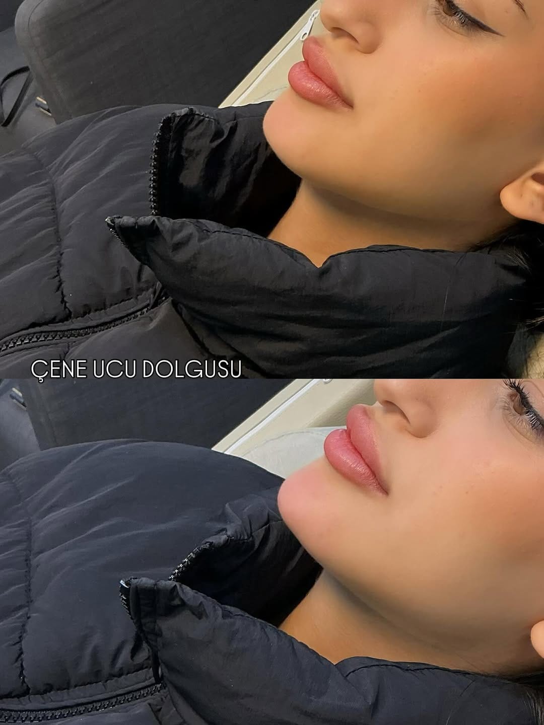 Post 9 by Derma Skins on Instagram (image)
