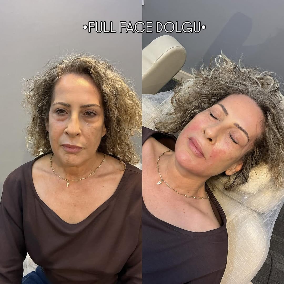 Post 10 by Derma Skins on Instagram (image)