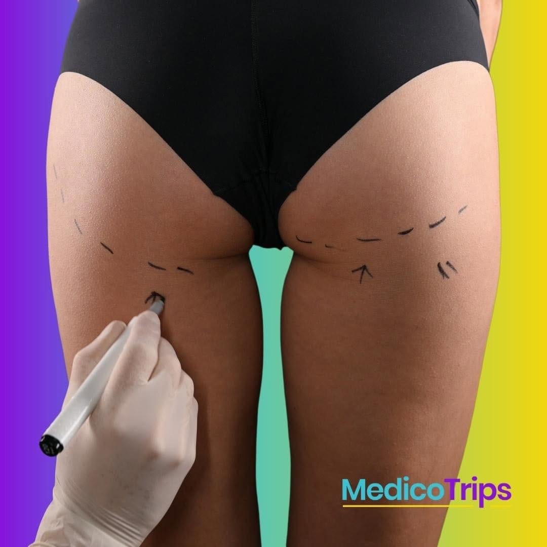 Post 5 by MedicoTrips on Instagram (image)