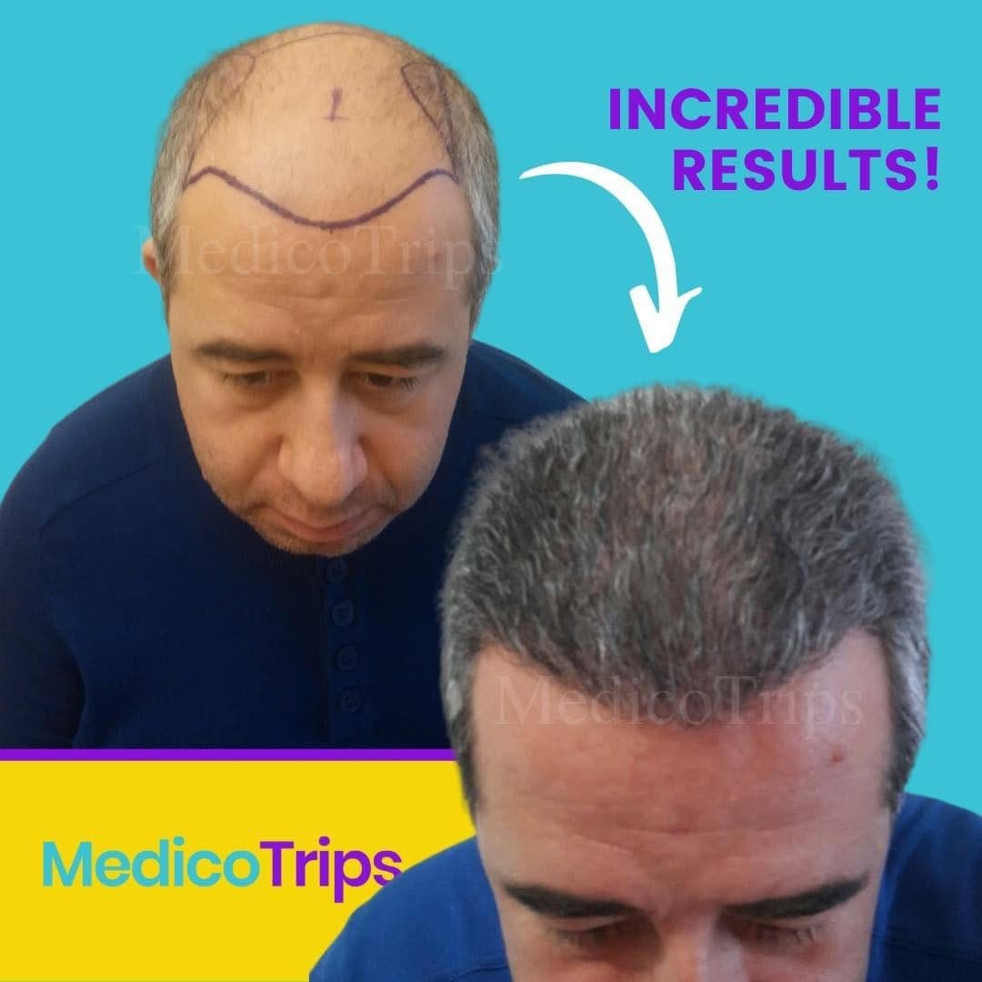 Post 6 by MedicoTrips on Instagram (image)
