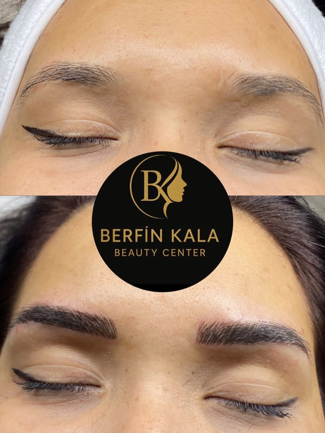 Post 1 by Berfin Kala Beauty on Instagram (image)