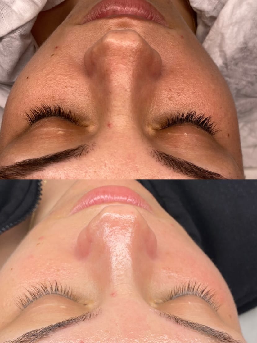 Post 4 by Berfin Kala Beauty on Instagram (carousel)