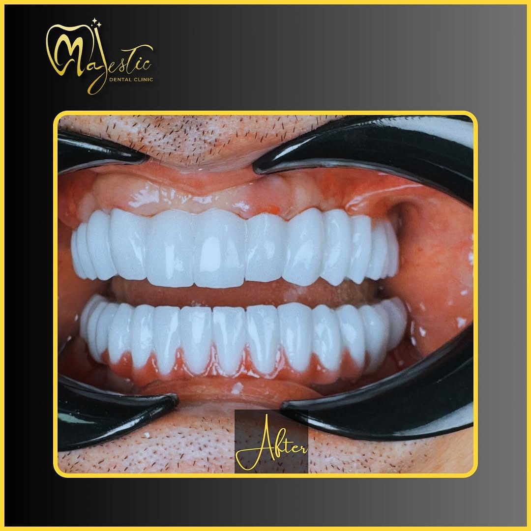 Post 2 by Majestic Clinic on Instagram (carousel)
