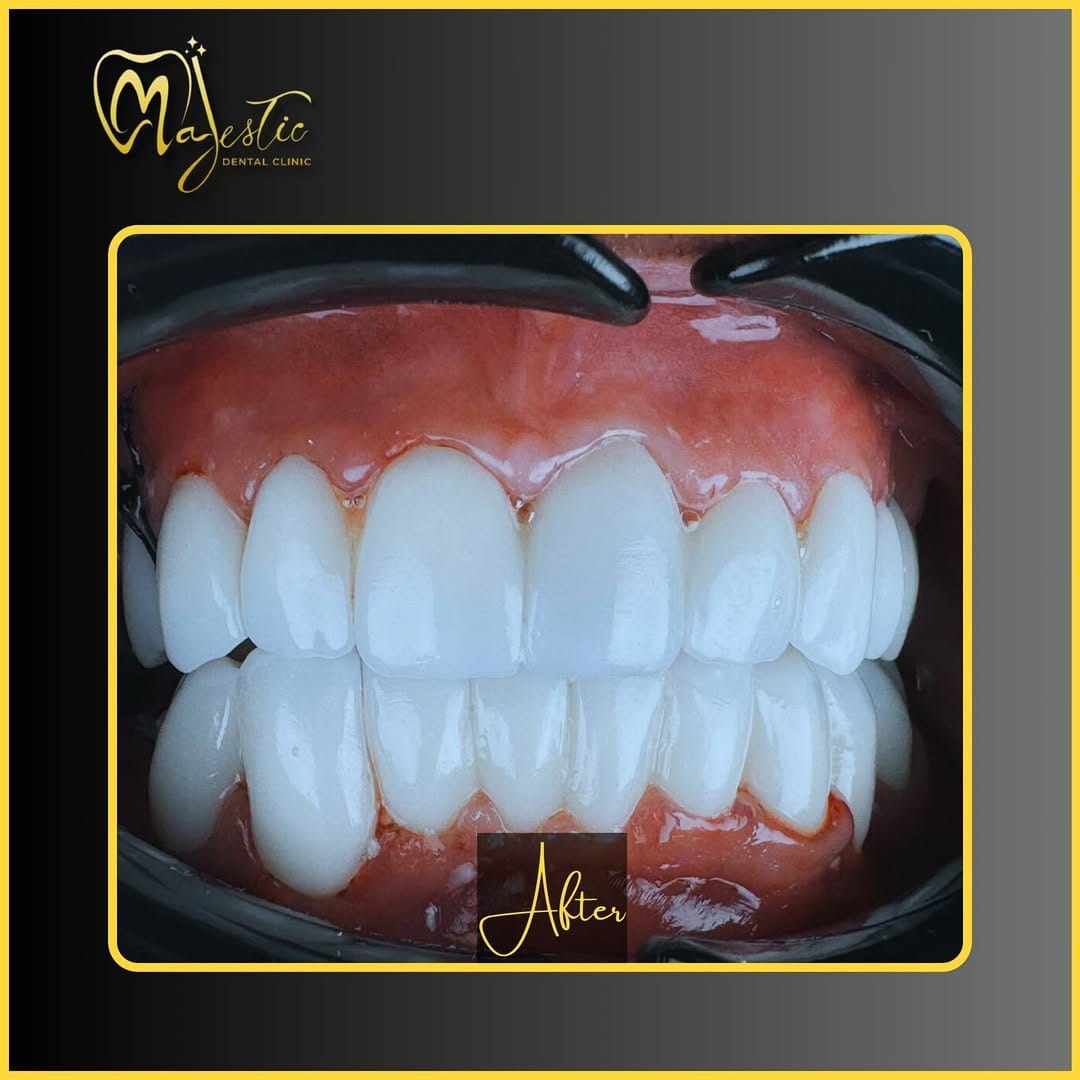 Post 6 by Majestic Clinic on Instagram (carousel)
