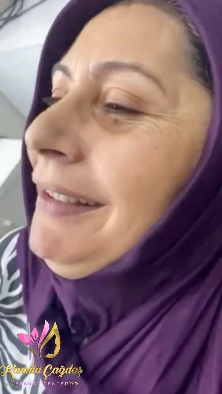 Post 10 by KAMILA ÇAGDAŞ BEAUTY on Instagram (video)