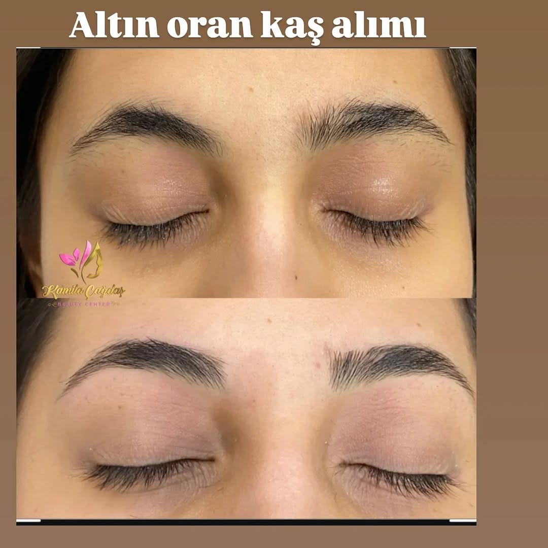 Post 6 by KAMILA ÇAGDAŞ BEAUTY on Instagram (image)