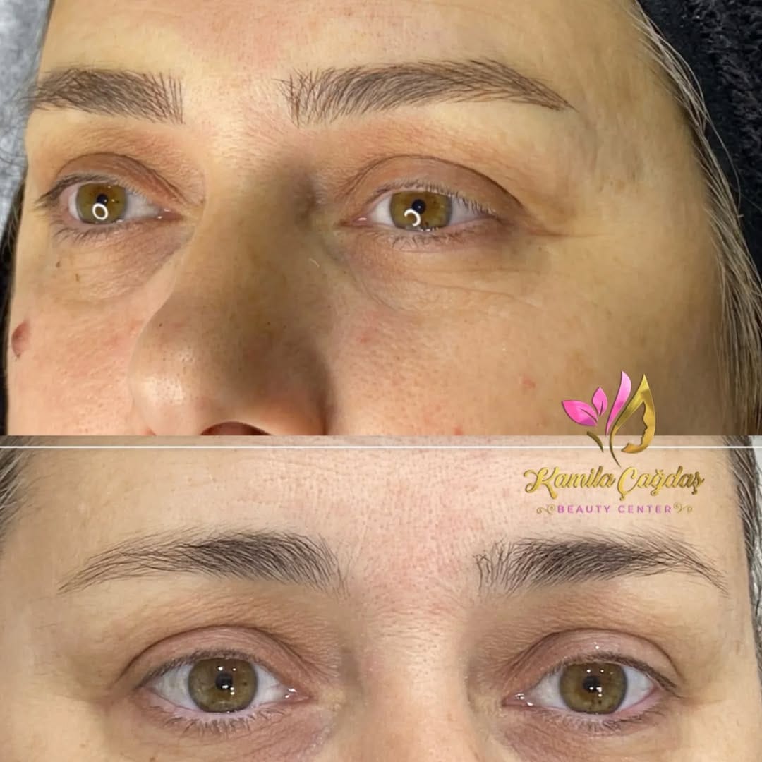 Post 2 by KAMILA ÇAGDAŞ BEAUTY on Instagram (image)