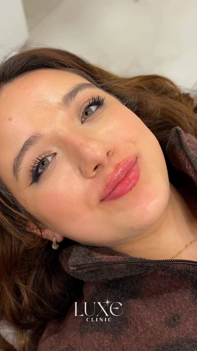 Post 1 by Luxe Clinic on Instagram (video)