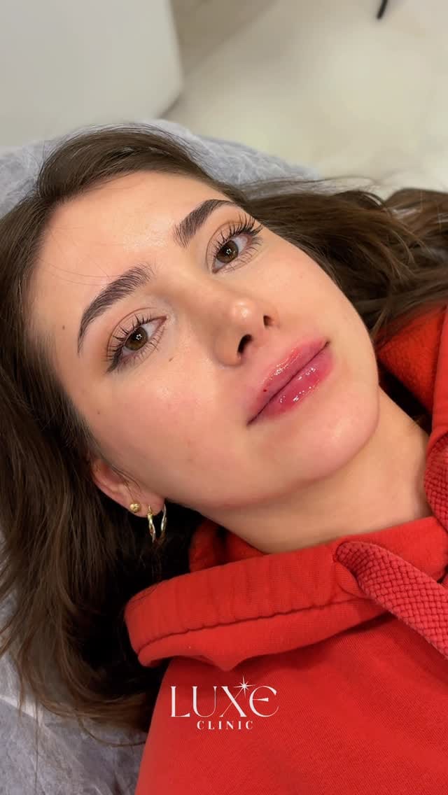 Post 3 by Luxe Clinic on Instagram (video)