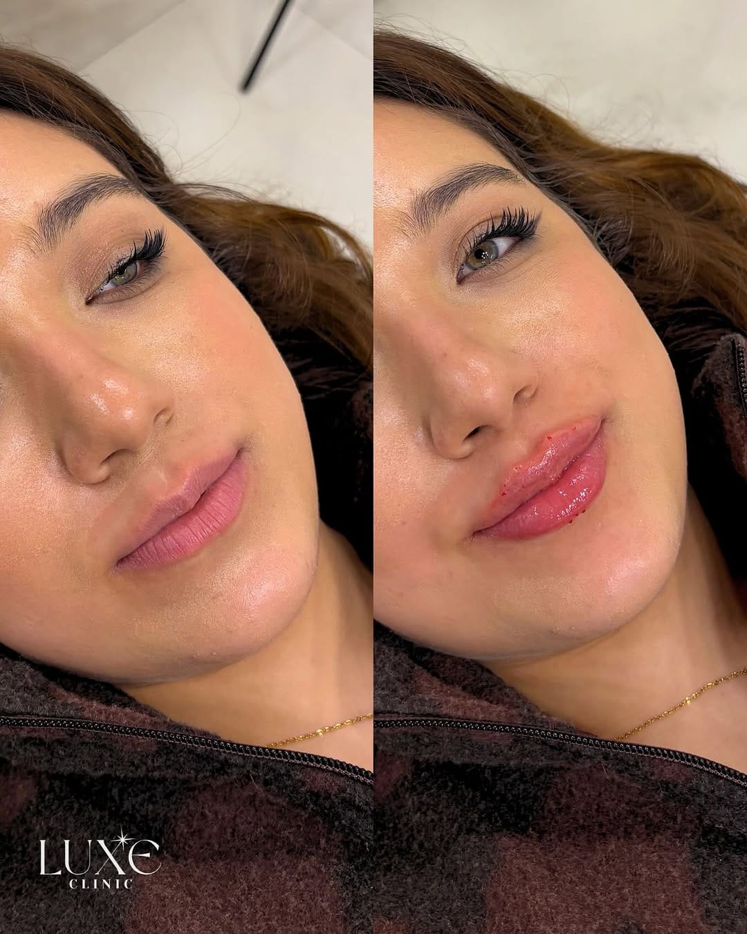 Post 2 by Luxe Clinic on Instagram (image)