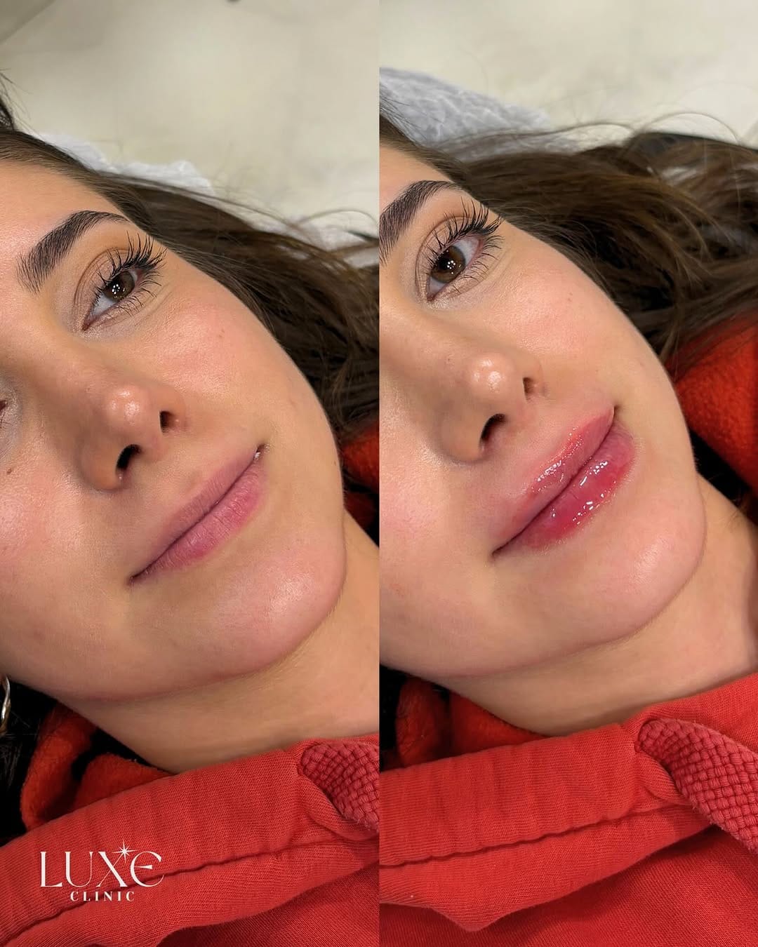 Post 4 by Luxe Clinic on Instagram (image)