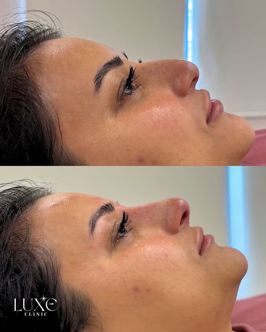 Post 6 by Luxe Clinic on Instagram (image)