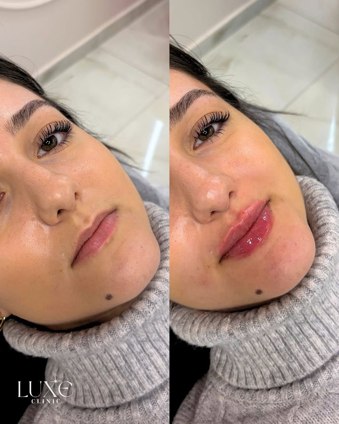 Post 7 by Luxe Clinic on Instagram (image)