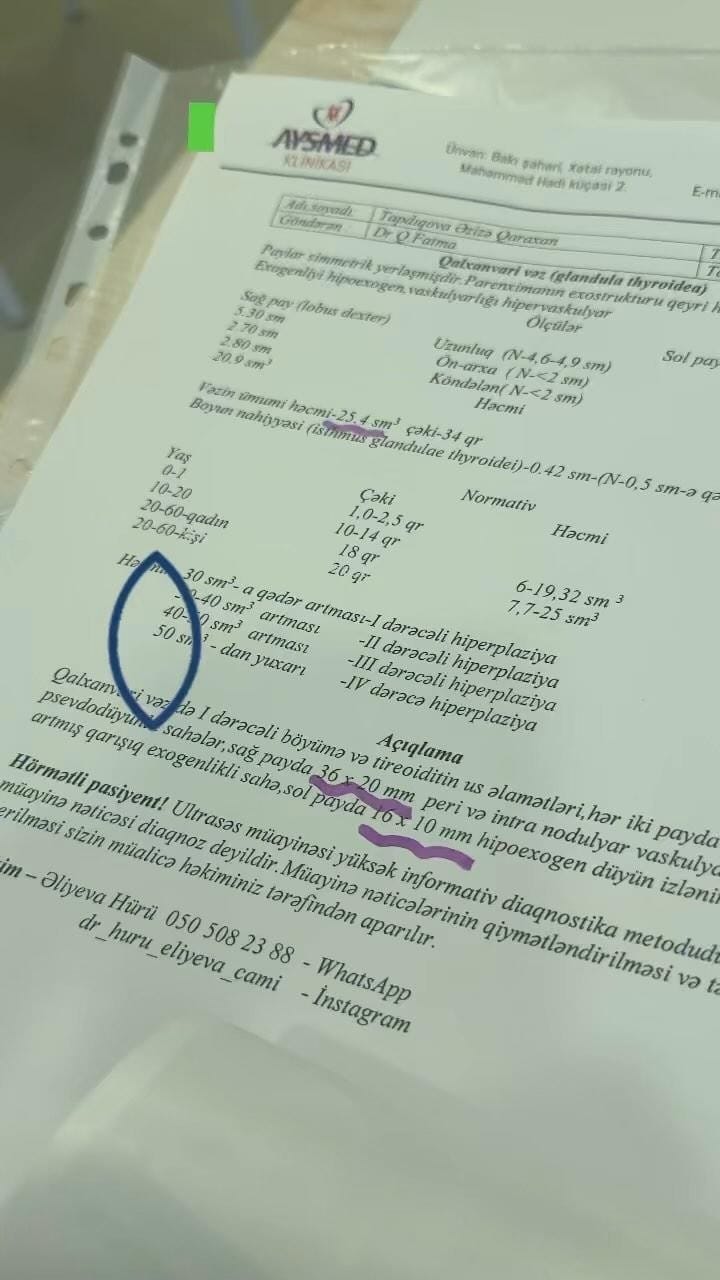 Post 6 by Günel Şiriyeva on Instagram (video)